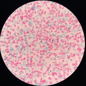 TCT Cervical Cytology Test Kit Papanicolaou Stain Solution Cell Sample Adult Medical Diagnostic Use - Product Image 1