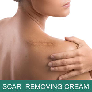 Crema para el Cuidado de la Piel de 30 ml, Portátil, de Bajo <span class=keywords><strong>Precio</strong></span>, Crema para Cicatrices, Crema para una Piel Suave, Éxito de Ventas al por Mayor - Product Image 6