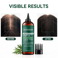 Huile capillaire à la rosemaine pour la croissance des cheveux avec extrait de ricin, jojoba et oignon – Huile botanique pour des cheveux plus épais et plus longs – Traitement capillaire pour femmes