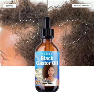 Luxfume 60ml Huile de croissance capillaire à la biotine, marque privée, huile de ricin naturelle pour femmes noires africaines, sérum de <span class=keywords><strong>repousse</strong></span> du cuir chevelu - Product Image 1