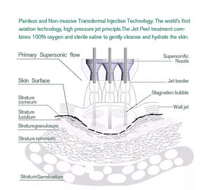 Le Jet Peel permet <span class=keywords><strong>la</strong></span> revitalisation du visage, l'exfoliation, <span class=keywords><strong>la</strong></span> correction des taches <span class=keywords><strong>de</strong></span> vieillesse, <span class=keywords><strong>la</strong></span> régularisation du teint et l'infusion active indolore. - Product Image 3