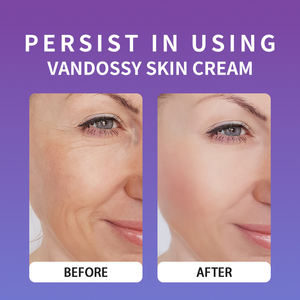 Krim Arbutin 7% + Asam Traneksamat 4% Niacinamide Glutathione untuk Bintik Hitam, Flek, Noda, Pigmentasi Perawatan Kulit Korea - Product Image 6