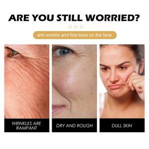 Crème à la bave d'escargot HOYGI 100g, 93% de mucine, hydratation longue durée, anti-rides, soin de la peau du visage, marque privée, avec ingrédient principal Glycérine - Product Image 2