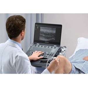 Mindray MX3 Clinical <strong>Portable</strong> Ultrasound <strong>Scanner</strong> Convex Linear Probe for Hospital &amp; Clinic Use - Product Image 5