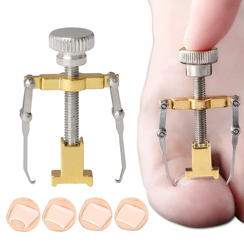 Outil correcteur d'ongle incarné pédicure fixateur d'ongle de pied soin des ongles orthèse traitement en acier inoxydable Onyxis Correction d'oignon