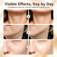 Appareil de luminothérapie rouge pour le visage, masseur facial, lumière à 3 couleurs, équipement de beauté à domicile, lifting du visage et du cou, produits de soin de la peau