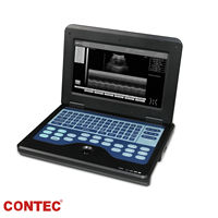 Échographe Portable CONTEC CMS600P2 Système de Diagnostic Ultrasonique avec Sonde Linéaire