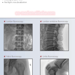 Système de radiographie numérique mobile FPD C-arm à positionnement rapide et haute efficacité, appareil de radiographie portable CMX-118F - Product Image 6