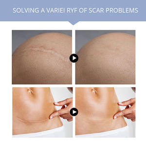 MSLAM كريم إصلاح الصبار العشبي علامات تمدد الجلد ، والحروق ، وجروح السكين ، جل لإصلاح الندبات الجراحية 20 جم - Product Image 5