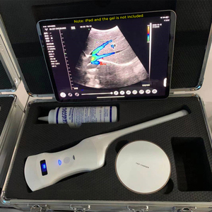 Scanner de Ultrassom <span class=keywords><strong>Doppler</strong></span> Colorido Sem Fio Tipo Sonda Convexa <span class=keywords><strong>Transvaginal</strong></span> de Dupla Cabeça Suresult - Product Image 2