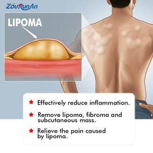Zourunan OEM Unguento per Linfoma Ascellare, Crema per Lipomi e Discomodi Nodulari - Product Image 3
