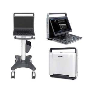 Mesin <span class=keywords><strong>Ultrasound</strong></span> Doppler Warna Laptop <span class=keywords><strong>SonoScape</strong></span> E2 dengan Probe Konveks Sumber Daya Listrik untuk Dijual - Product Image 1