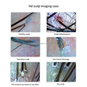 Portable 200X analyseur de cuir chevelu et de cheveux appareil de test de portée de cheveux - Product Image 4