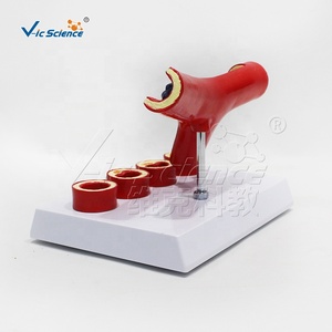 Y-образная модель атеросклероза артерии раздельная модель тромба анатомические модели анатомических моделей сосудов кровеносных сосудов - Product Image 6