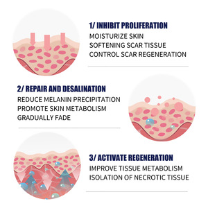 Crema Reparadora de Cicatrices EELHOE, Aclara Cicatrices de <span class=keywords><strong>Embarazo</strong></span> y Cirugí<span class=keywords><strong>a</strong></span>, Suaviza la Piel, Crema para el Cuidado de la Piel, 50 ml - Product Image 2
