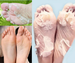 Private Label Wholesale <b>Moisturizing</b> Exfoliating Foot Mask <b>Socks</b> Lavender Feet Exfoliating Foot Mask - Product Image 4