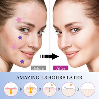 OEM SADOER personnalisé coréen patch de guérison des boutons d'acné maquillage végétalien autocollant de dissolvant de taches de peau d'acné patchs d'acné pour les soins de la peau du visage