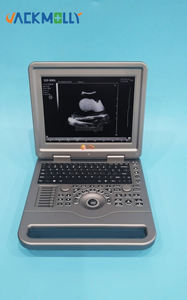Sistem Diagnostik Portabel JM-806A Layar LED 12-Inci Mesin <span class=keywords><strong>Ultrasound</strong></span> BW <span class=keywords><strong>2D</strong></span> Notebook Laptop untuk Dokter Hewan - Product Image 4