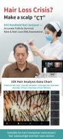Analyseur capillaire portable avec technologie de topographie 3D, appareil portatif pour l'analyse commerciale du cuir chevelu