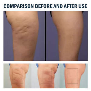 Cuentas de coagulación para baño de pies, adelgazamiento, esculpir el cuerpo, aliviar el dolor de articulaciones venosas, cuidado corporal, cuentas de coagulación para baño de pies - Product Image 4