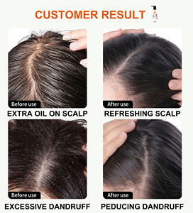 Sampo pereda gatal yang menenangkan eksim ketombe & <span class=keywords><strong>Psoriasis</strong></span> bantuan untuk kulit kepala sensitif & kering dengan Oatmeal dan Chamomile - Product Image 6