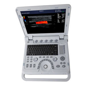 콘텍 CMS1700A 컬러 도플러 혈관 초음파 심장 초음파 기기 - Product Image 4