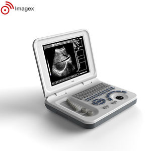<span class=keywords><strong>Laptop</strong></span> Draagbare Ultrasone Machine Met Convexe Transvaginale En Lineaire Array <span class=keywords><strong>Transducer</strong></span> - Product Image 4