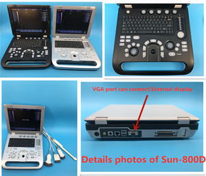 Appareil d'échographie <span class=keywords><strong>portable</strong></span> SUN-800D1 noir et blanc, prix, scanner d'échographie numérique complet - Product Image 4