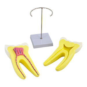 Modelo anatómico de diente molar, modelo de práctica Dental, modelos educativos de odontología, dientes de entrenamiento de biología médica - Product Image 4