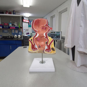 Modèle d'anatomie du rectum avec pathologies Modèle d'anatomie du rectum avec pathologies Démonstration de la maladie du rectum pour les sciences médicales - Product Image 4