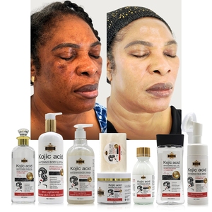 Nhãn Hiệu Riêng Da Làm Trắng Set Kojic Huyết Thanh Tại Chỗ Mặt Kem Tẩy Trắng Kem Dưỡng Da Kojic Axit Xà Phòng Chăm Sóc Da Set Cho Phụ Nữ Da - Product Image 1