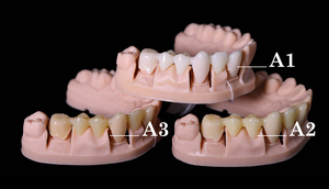 Impresora 3D Imprime Coronas Dentales Permanentes de Resina Sintética, Marca <span class=keywords><strong>IFUN</strong></span>, IF3180 Líquido de Alta Precisión, Biocompatible, 100% Puro - Product Image 3