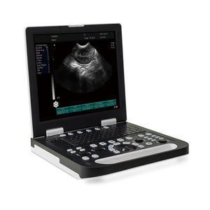 Peralatan medis hewan portabel murah mesin ultrasound ecardiografi dokter hewan ultrasound portabel portabel - Product Image 1