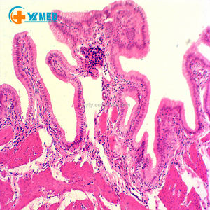 สไลด์กล้องจุลทรรศน์แบบกำหนดเอง ชิ้นเนื้อเยื่อผิวหนังแบบเรียบง่ายของมนุษย์ สไลด์กล้องจุลทรรศน์แบบเตรียมสำเร็จสำหรับการตรวจวิเคราะห์เนื้อเยื่อแบบใส - Product Image 2