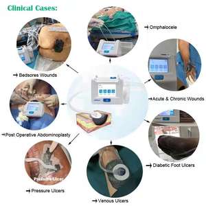 Otomatik instilasyon depolama tedavisi ile negatif basınç yara terapi sistemi yara iyileşmek için tıbbi cihaz sözler - Product Image 4