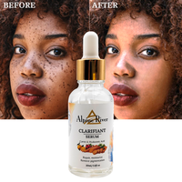 Produit de soin de la peau naturel et biologique à la vitamine E et à la carotte pour éliminer les taches brunes, sérum de soin de la peau hydratant et antioxydant à la vitamine C de Corée