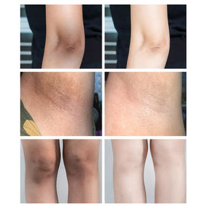 개인 라벨 스킨 케어 페이스 크림 코직산 콜라겐 얼굴 미백 피부 미백 크림 검은 피부 - Product Image 5