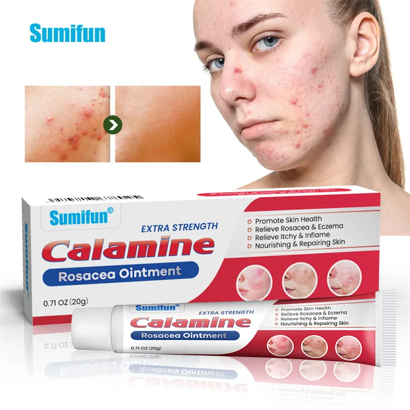 Sumifun calamine crème anti-eczéma psoriasis rosacée urticaire traitement des démangeaisons pommade crème anti-acné pour le psoriasis