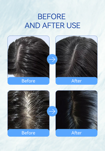MOCHEQI <span class=keywords><strong>Shampoo</strong></span> Anticaduta Biologico di Alta Qualità a Prezzo di Fabbrica, Nutriente e <span class=keywords><strong>Antiforfora</strong></span> per <span class=keywords><strong>Capelli</strong></span> Ricci e <span class=keywords><strong>Grassi</strong></span> - Product Image 5