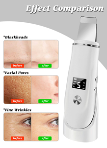Espátula Eléctrica Limpiadora Facial, Exfoliante, Eliminador de Puntos Negros, Limpieza Profunda Facial, Lifting Iónico, Limpiador de Poros y Acné - Product Image 4