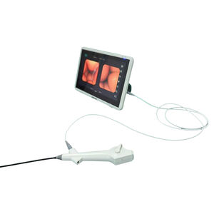 Ureteroscopio Flexible Redpine, Uroscopio, Ureteroscopios, Dispositivo Endoscópico con Cámara - Product Image 2