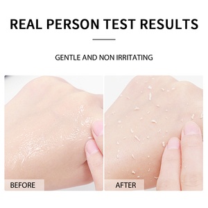 Sérum exfoliant éclaircissant au riz noir, sérum éclaircissant pour <span class=keywords><strong>la</strong></span> <span class=keywords><strong>peau</strong></span>, sérum exfoliant au riz, niacinamide, sérum pour affiner <span class=keywords><strong>les</strong></span> pores, réparation de <span class=keywords><strong>la</strong></span> <span class=keywords><strong>peau</strong></span>, sérum au riz doux - Product Image 5