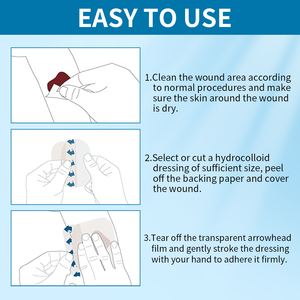 Sanfter Transparenter Wundverband - Keine Schabadhafteung, Einfache Entfernung & Hochabsorbierender Hydrophiler Verband - Product Image 6