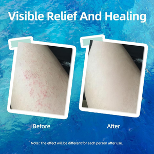 <span class=keywords><strong>Crema</strong></span> <span class=keywords><strong>Facial</strong></span> Reparadora Profunda, Hidratante y <span class=keywords><strong>Protectora</strong></span> para el Cuidado de la Piel Después del Tratamiento, la Más Vendida del 2025 - Product Image 3