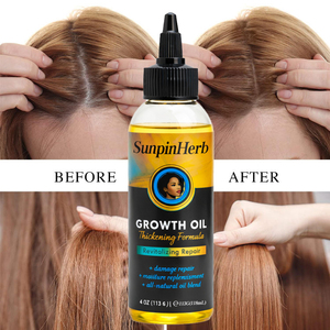 Aceite de Romero para el Crecimiento del Cabello Afro, Tratamiento para el Cuero Cabelludo, Hidratante, Reparador, Anti-Rotura, Marca Privada, Suministro al por Mayor - Product Image 2