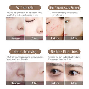 Máquina Facial de Hidrodermoabrasión con Oxígeno Beauty 7 en 1, Limpieza Profunda, Múltiples Configuraciones - Product Image 3