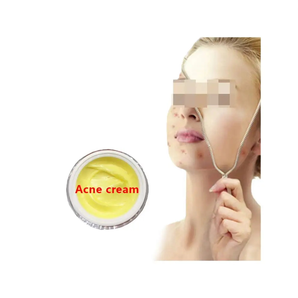Best Quality Soothing Skin Care Dark Spot Repair Face Gel Pimples Acne Scar Mark Removal Cream Anti Acne Gel