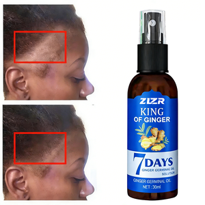 Green Ginger Anti-Hair Prevent Loss Oil,Ginger 7 Days Hair Growth Nourishing Regrowth <b>Spray</b>,King of Ginger Spraying - Product Image 1