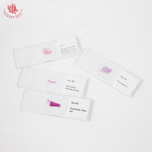 Diapositivas de patología humana FRT2002 Suministro médico 100 tipos Microscopio de patología humana Diapositiva preparada Diapositiva profesional biológica - Product Image 5