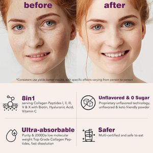 Polvere di Peptidi di Collagene Multiplo Tipo I II III V X Spedizione Gratuita dal Magazzino USA - Product Image 6